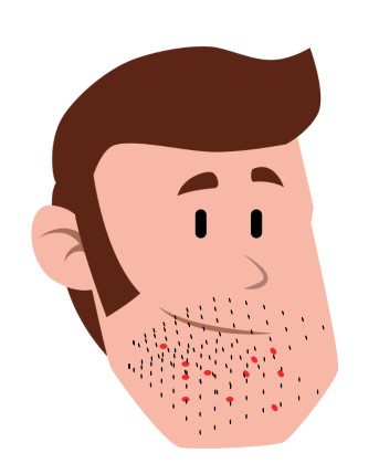 mejor máquina de afeitar para barbas duras y piel sensible