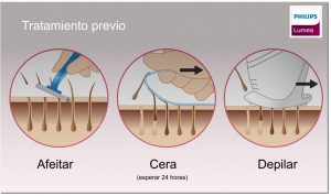tratamiento previo